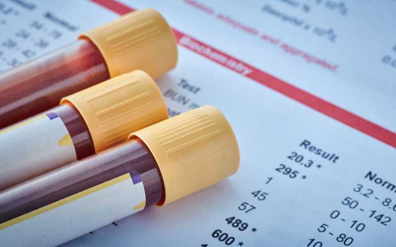 juicio rápido por alcoholemia juicio rápido por alcoholemia
